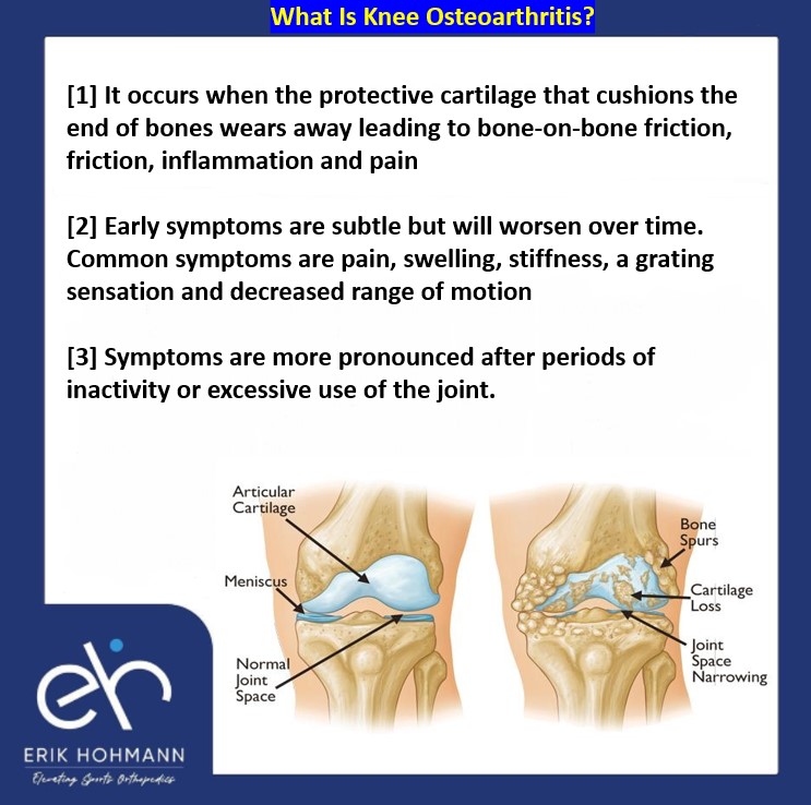 What is Knee Osteoarthritis