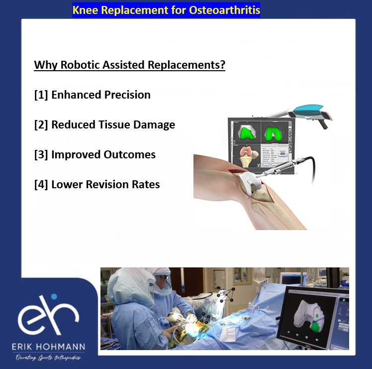 Knee Replacement for Osteoarthritis