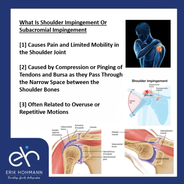 What Is Shoulder Impingement Or Subacromial Impingement - Burjeel 